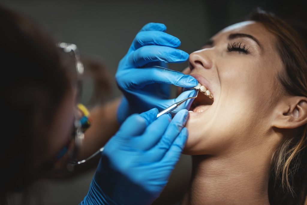 How Long Does Dental Bonding Last?