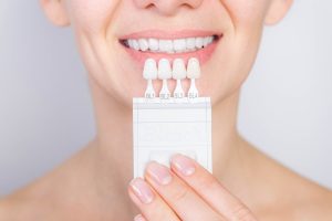 Veneers is one of the many reatments offered by Smile Design Dentistry